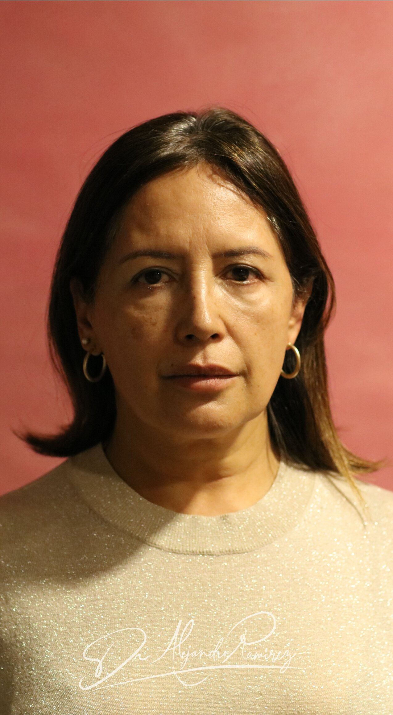 Caso 02 — antes