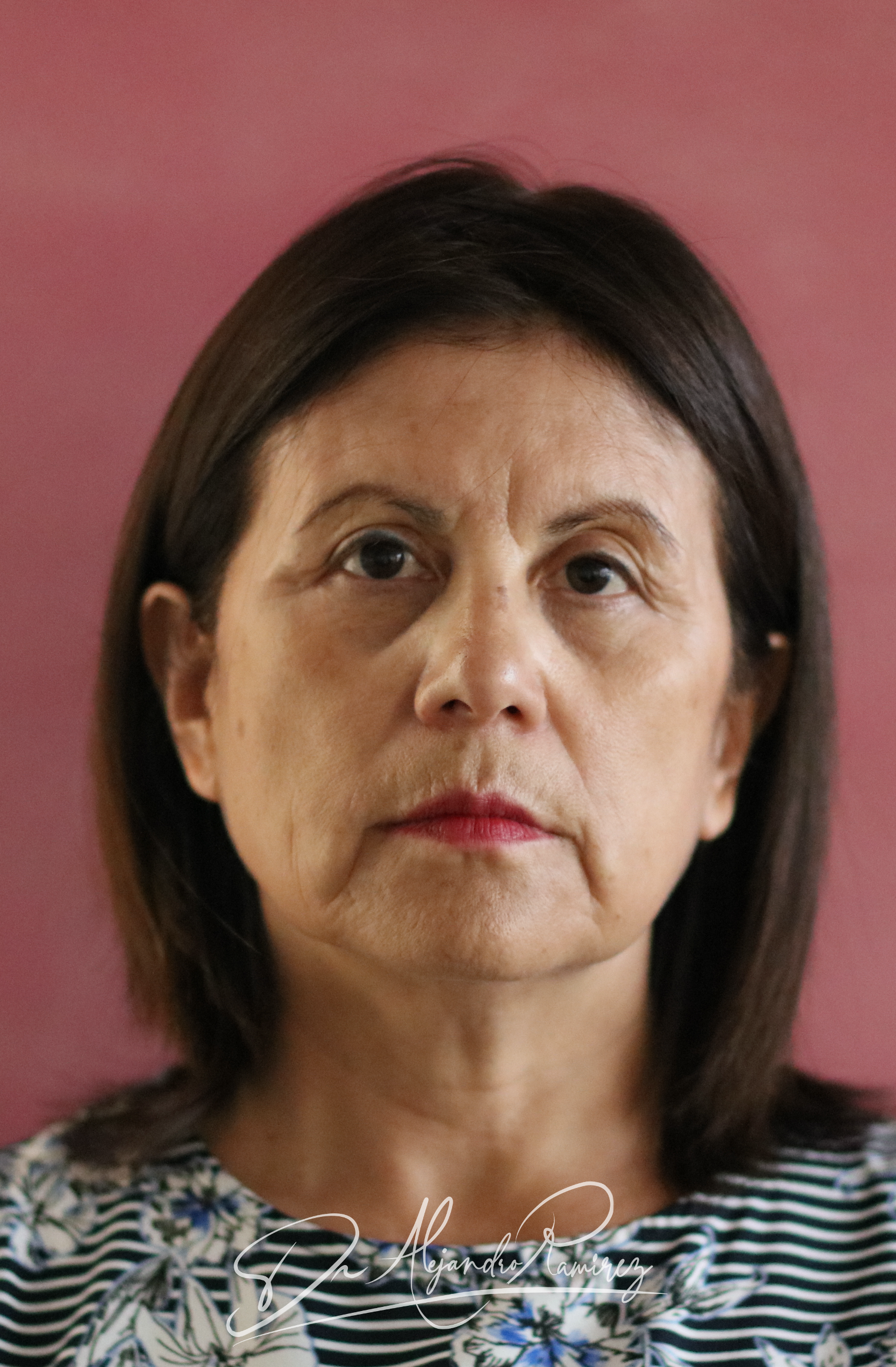 Caso 03 — antes