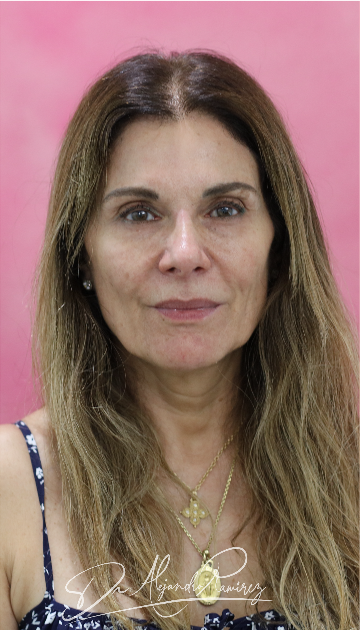 Caso 01 — antes